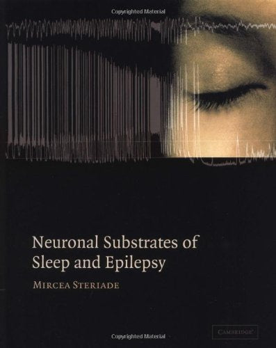 Neuronal Substrates Of Sleep And Epilepsy