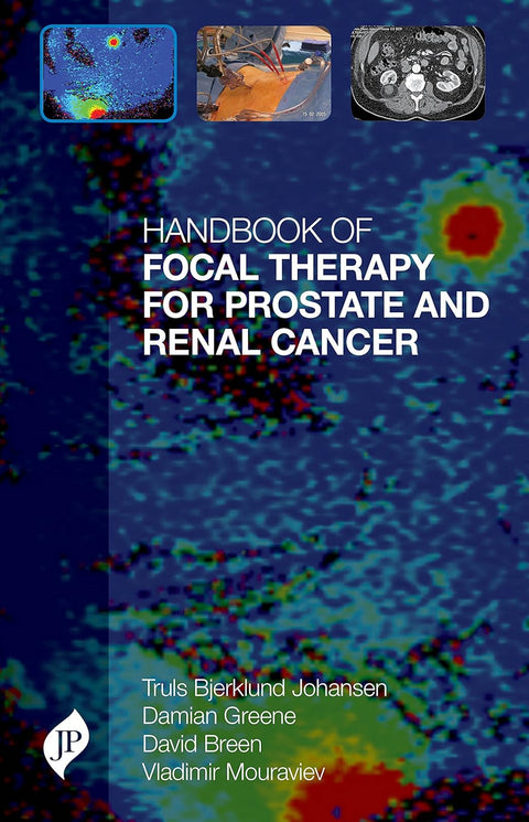 Handbook Of Focal Therapy For Prostate And Renal Cancer 1/E 2017