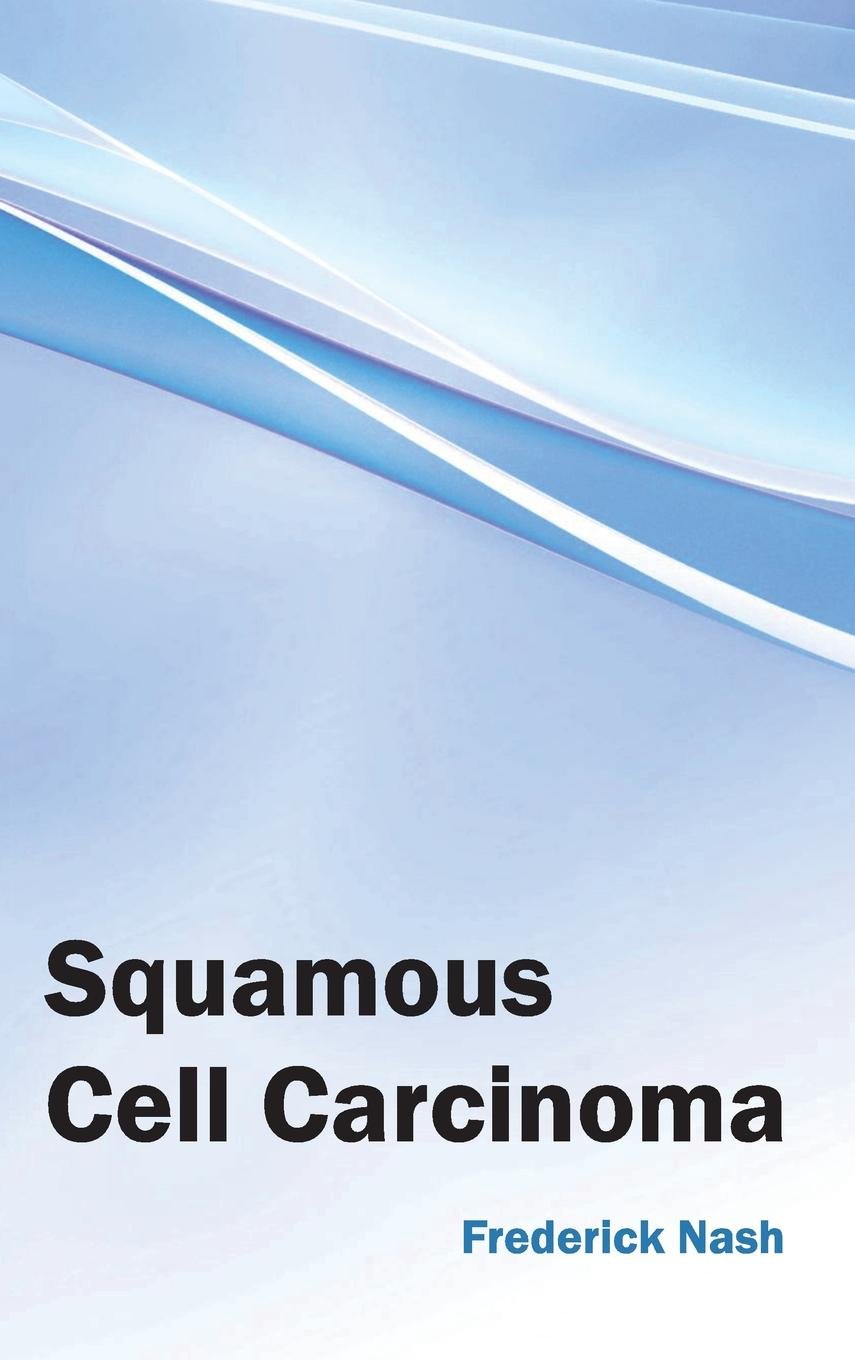 Squamous Cell Carcinoma : 1/E 2015