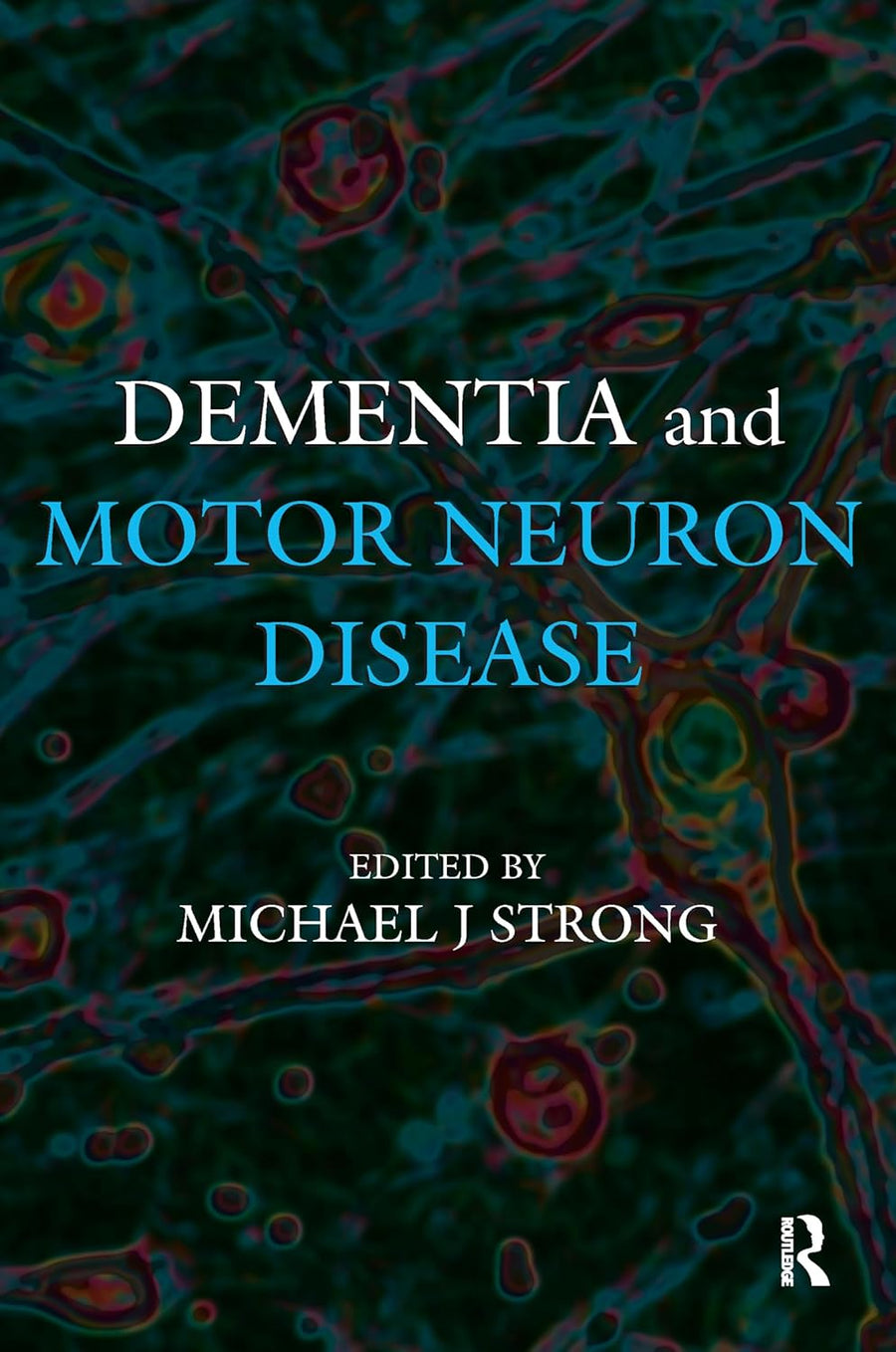 Dementia And Motor Neuron Disease