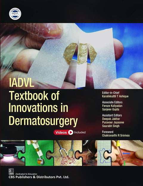 Iadvl Textbook Of Innovations In Dermatosurgery (HB)