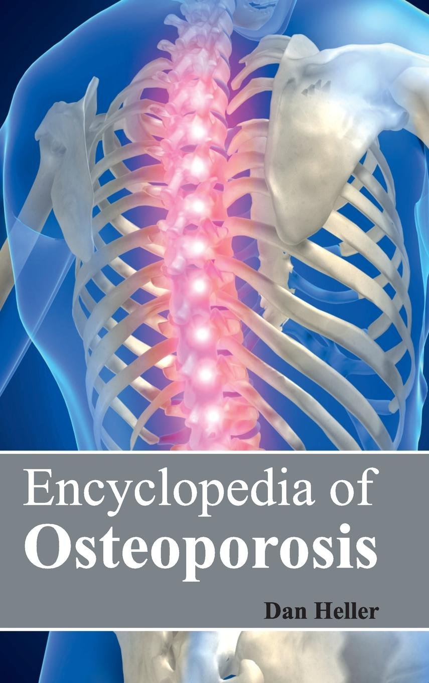 Encyclopedia Of Osteoporosis : 1/E 2015