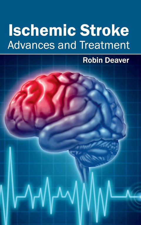 Ischemic Stroke: Advances And Treatment
