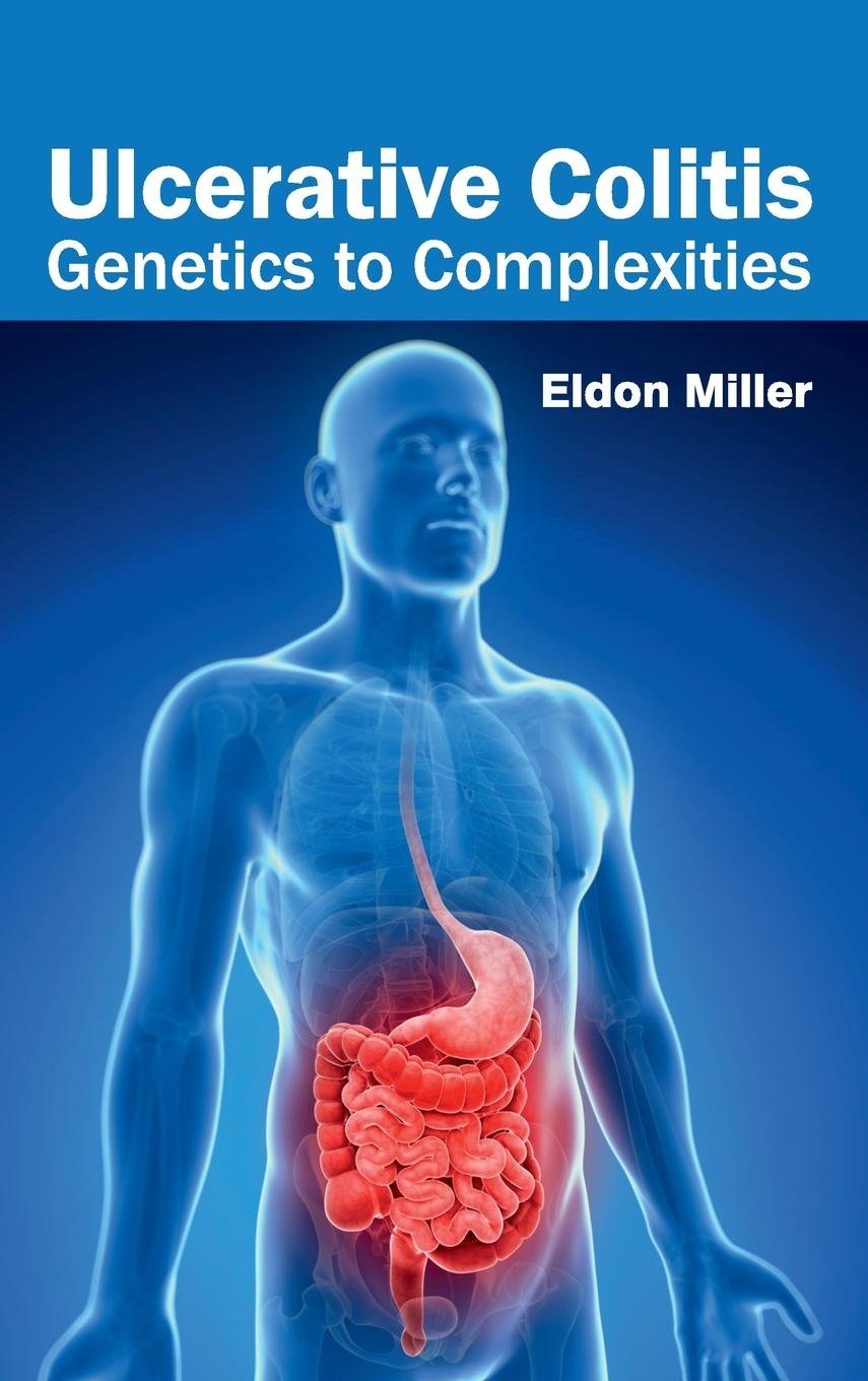 Ulcerative Colitis: Genetics To Complexities; 1/E 2015