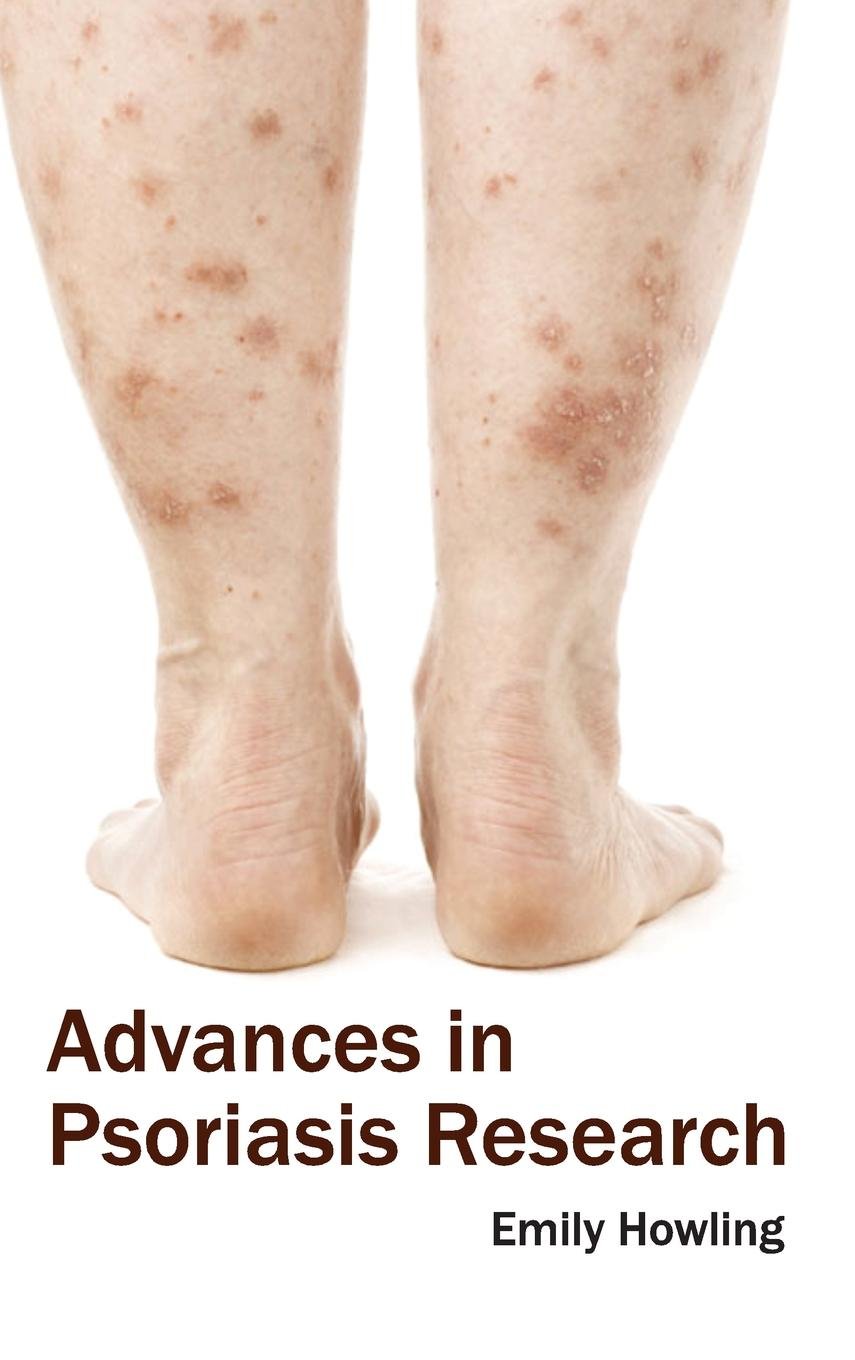 Advances In Psoriasis Research : 1/E 2015