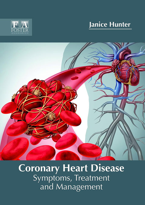 Coronary Heart Disease: Symptoms, Treatment And Management; 1/E 2018
