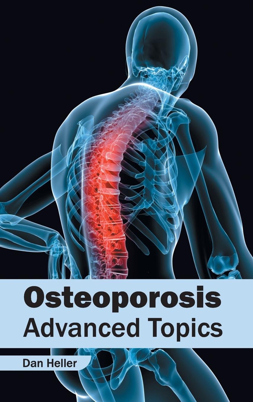Osteoporosis: Advanced Topics; 1/E 2015