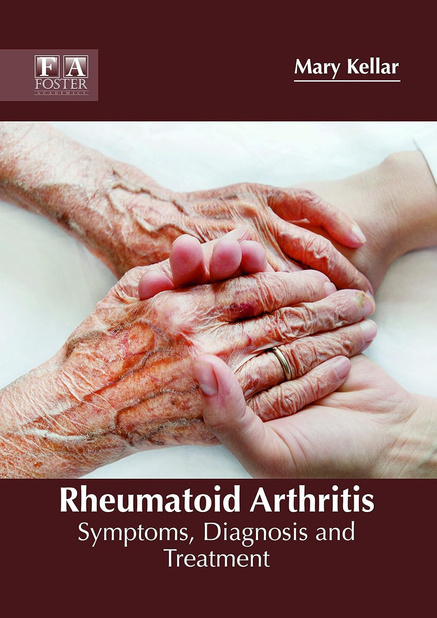 Rheumatoid Arthritis: Symptoms, Diagnosis And Treatment; 1/E 2018