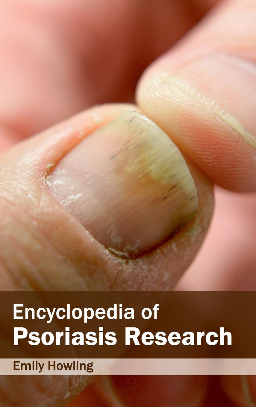 Encyclopedia Of Psoriasis Research