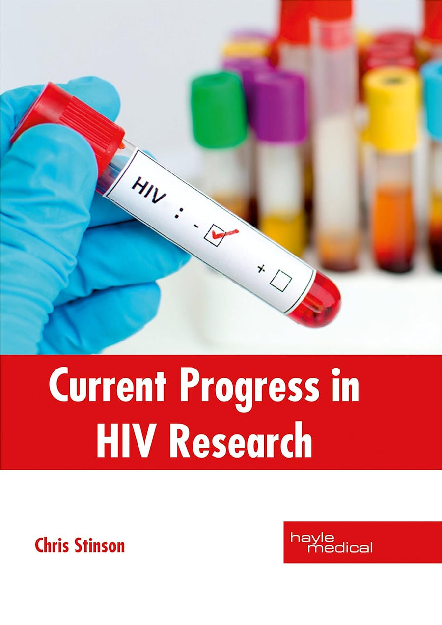 Current Progress In HIV Research : 1/E 2017