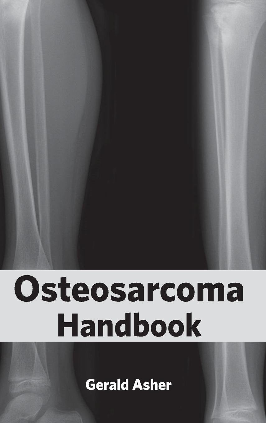 Osteosarcoma Handbook : 1/E 2015