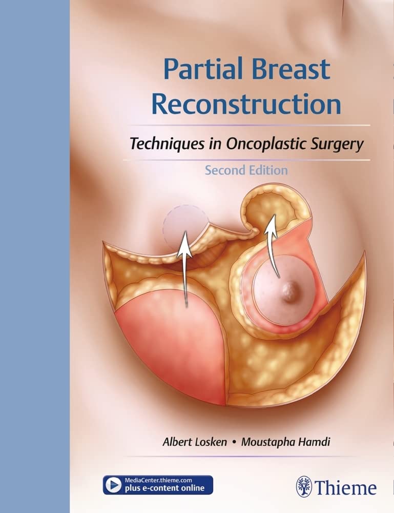 Partial Breast Reconstruction: Techniques in Oncoplastic Surgery, 2nd Edition
