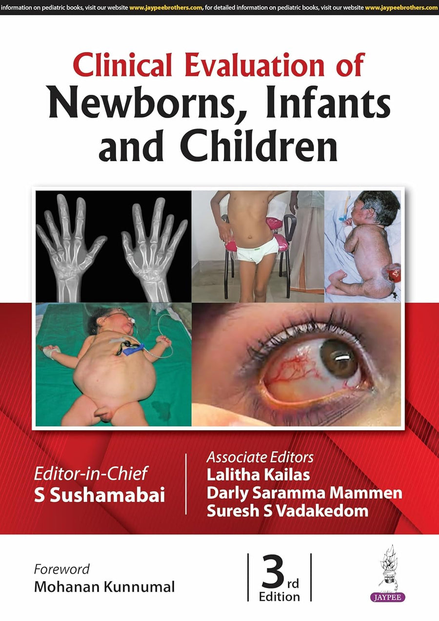 Clinical Evaluation of Newborns, Infants and Children