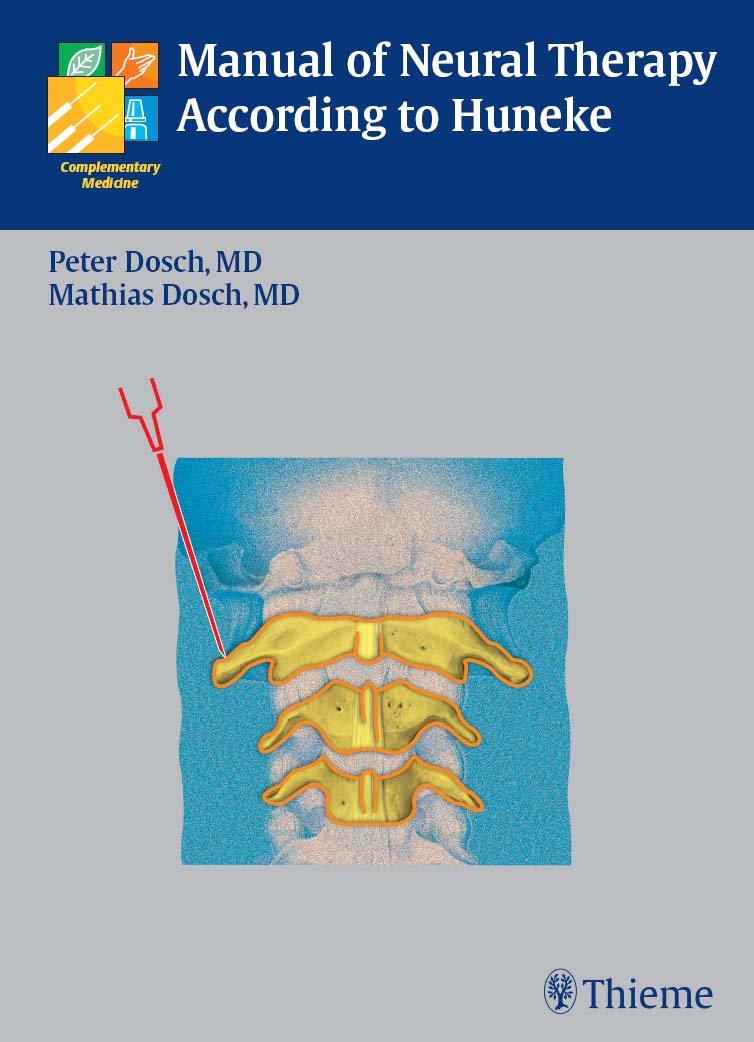 Neurosonology and Neuroimaging of Stroke