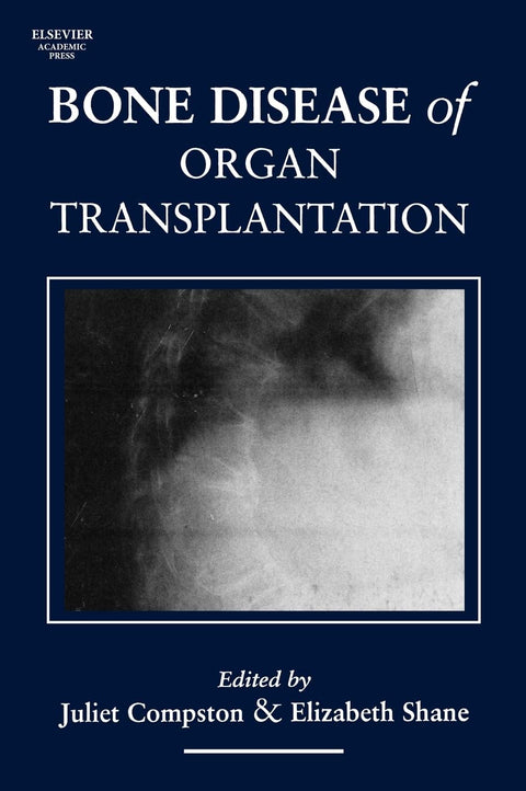 Bone Disease Of Organ Transplantation
