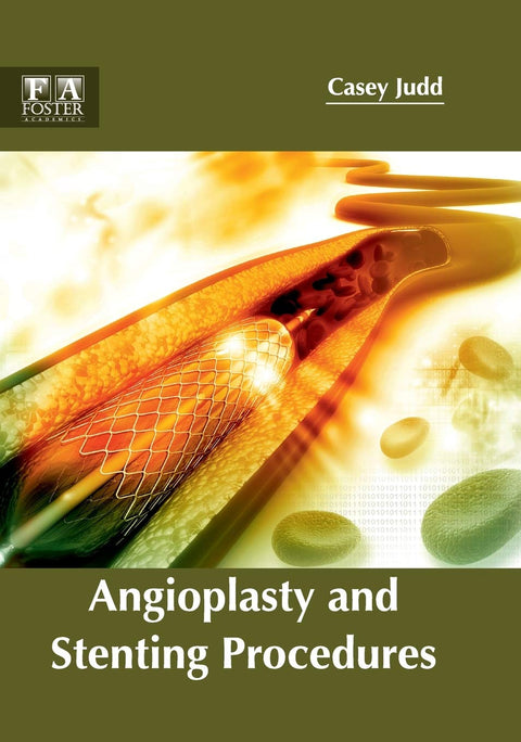 Angioplasty And Stenting Procedures : 1/E 2017