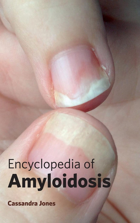 Encyclopedia Of Amyloidosis : 1/E 2015