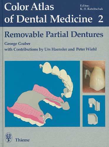 Color Atlas Of Dental Medicine 2 Removable Partial Dentures