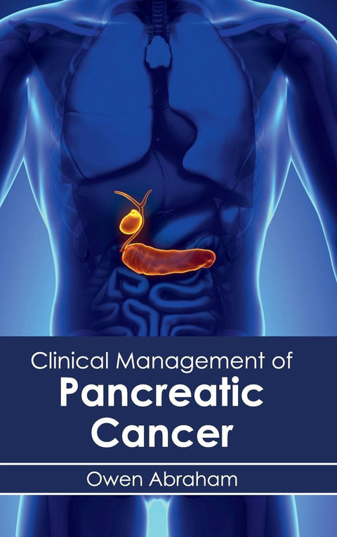 Clinical Management Of Pancreatic Cancer