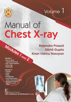 Image 2 of Manual of Chest X-ray: Modules 1 to 4, Vol 1 and Vol 2 Set (PB)