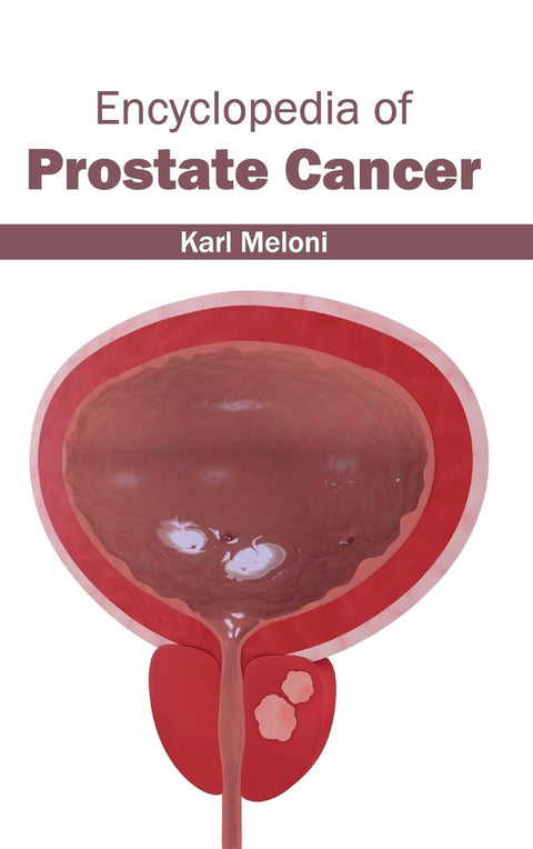 Encyclopedia Of Prostate Cancer