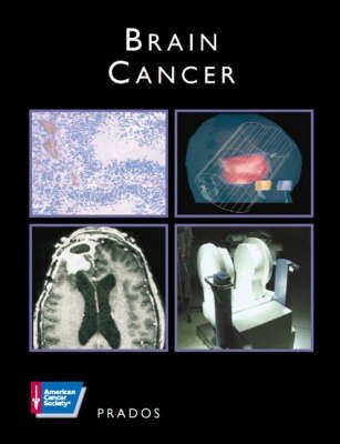 Brain Cancer by Prados