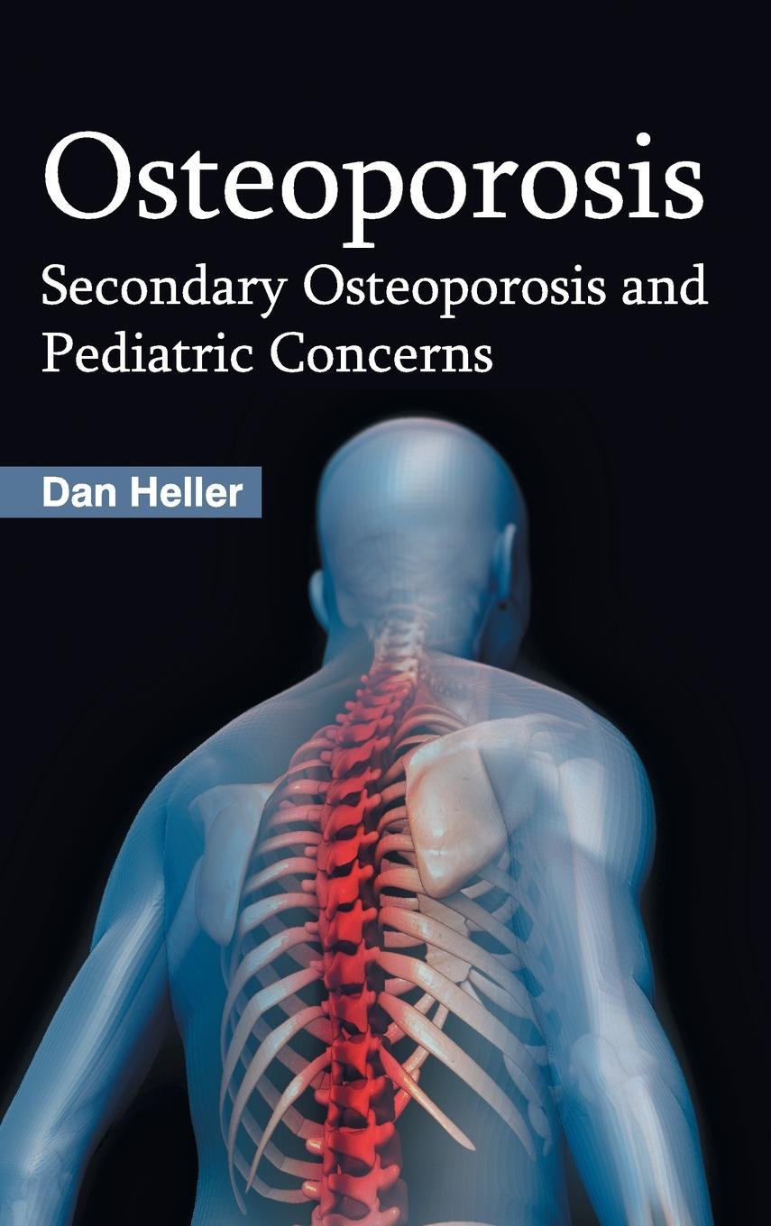 Osteoporosis: Secondary Osteoporosis And Pediatric Concerns; 1/E 2015