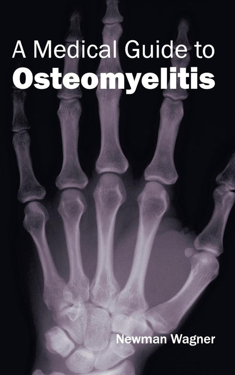 A Medical Guide To Osteomyelitis