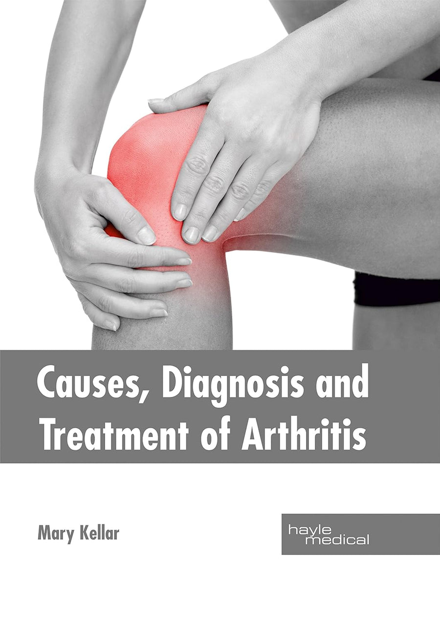 Causes, Diagnosis And Treatment Of Arthritis : 1/E 2017