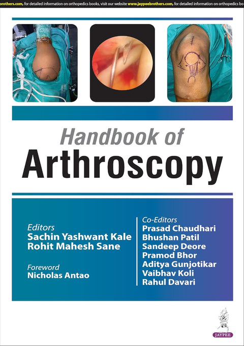 Handbook of Arthoscopy