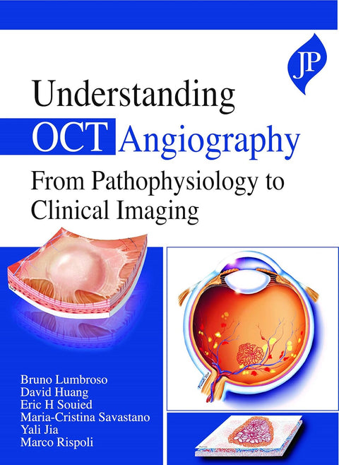 Understanding OCT Angiography from Pathophysiology to Clinical Imaging