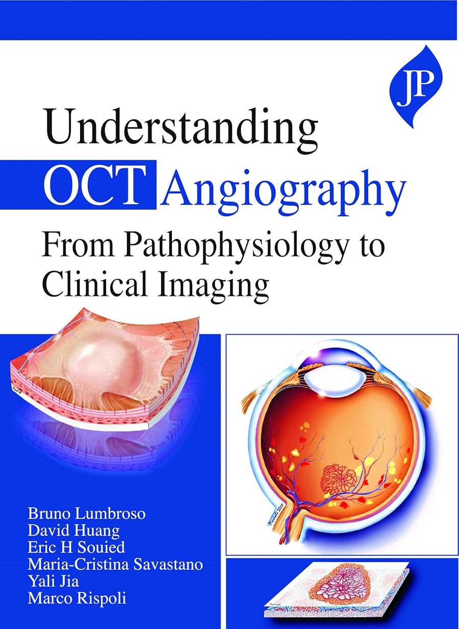 Understanding OCT Angiography from Pathophysiology to Clinical Imaging