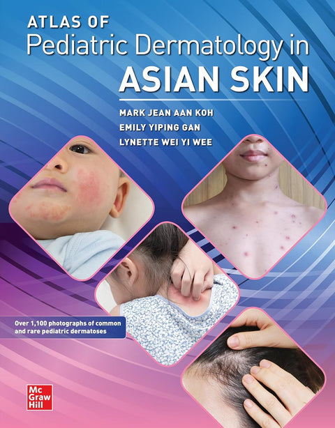 Atlas Of Pediatric Dermatology In Asian Skin (PB)
