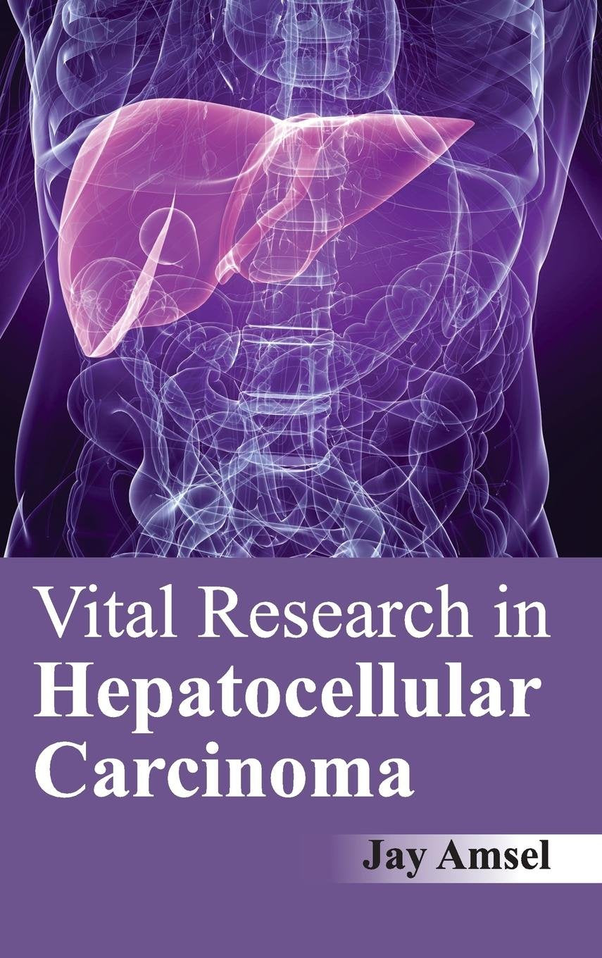 Vital Research In Hepatocellular Carcinoma : 1/E 2015