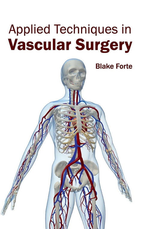Applied Techniques In Vascular Surgery : 1/E 2015