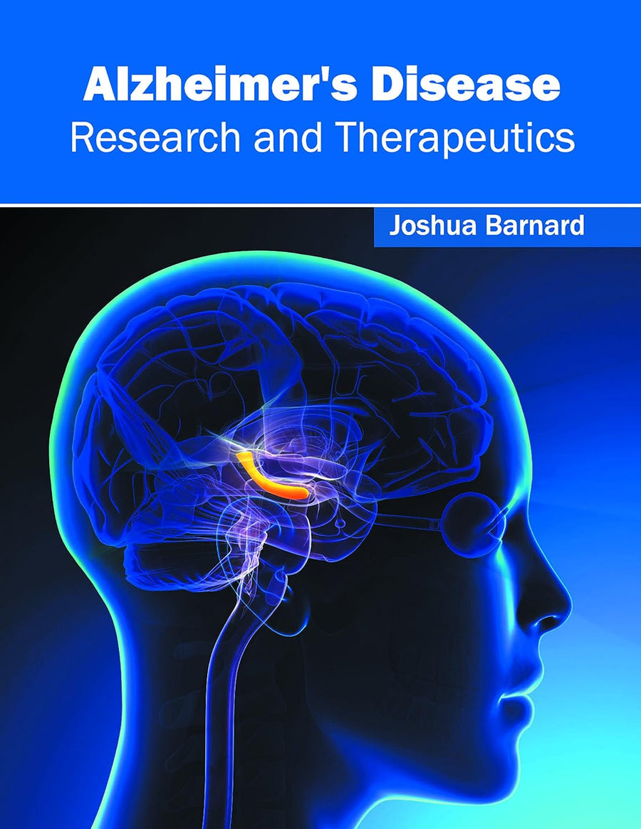 Alzheimer's Disease: Research And Therapeutics