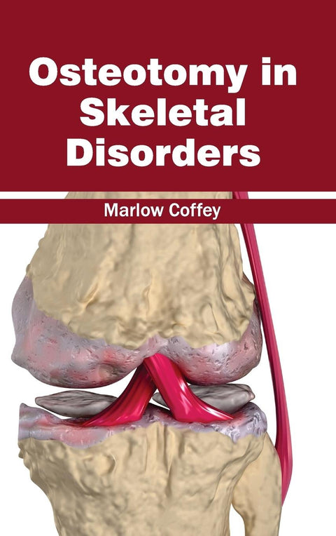 Osteotomy In Skeletal Disorders