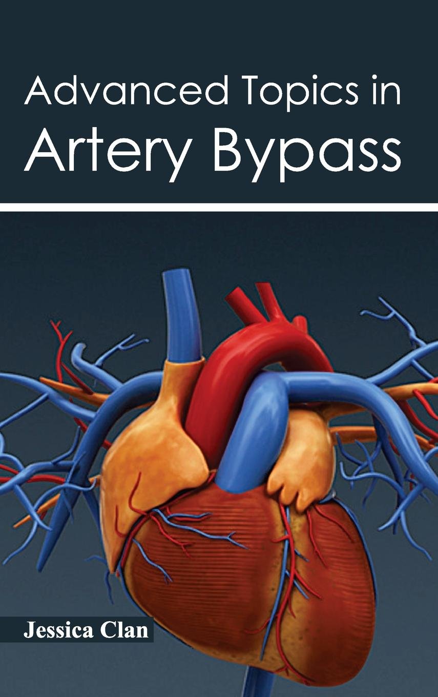 Advanced Topics In Artery Bypass
