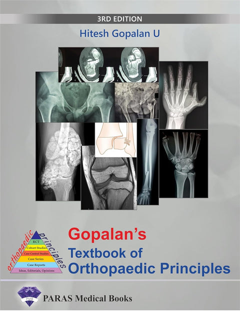 Gopalan's Textbook of Orthopaedic Principles, 3E