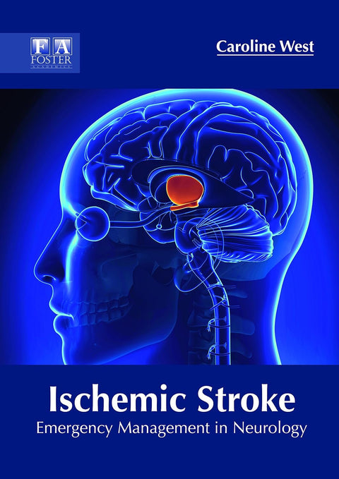 Ischemic Stroke: Emergency Management In Neurology; 1/E 2018
