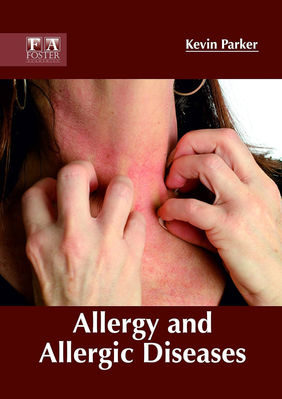Allergy And Allergic Diseases : 1/E 2018