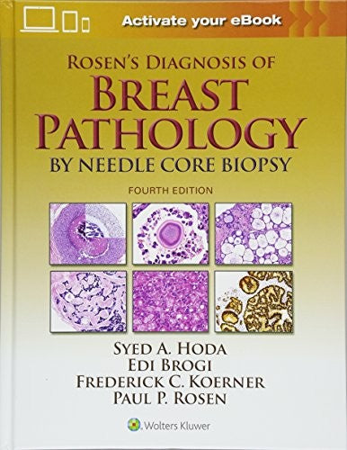 Rosen's Diagnosis of Breast Pathology by Needle Core Biopsy (HB)