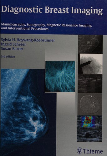 Diagnostic Breast Imaging: Mammography, Sonography, MRI