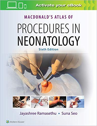 Macdonald'S Atlas Of Procedures In Neonatology, 6Ed South Asian Edition